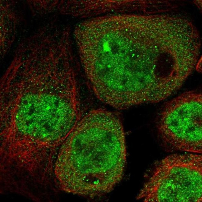 C13orf7 Antibody in Immunocytochemistry (ICC/IF)