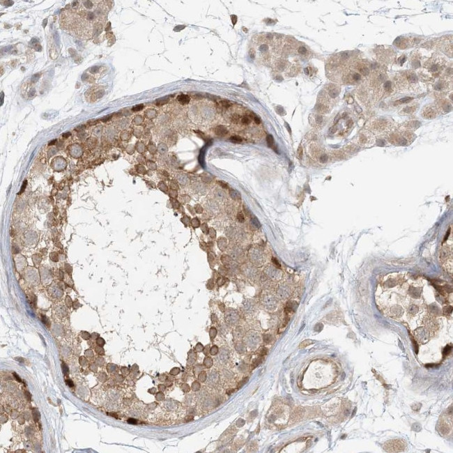 C13orf7 Antibody in Immunohistochemistry (IHC)