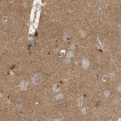 C13orf7 Antibody in Immunohistochemistry (IHC)