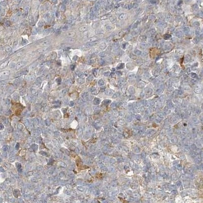 C13orf7 Antibody in Immunohistochemistry (IHC)