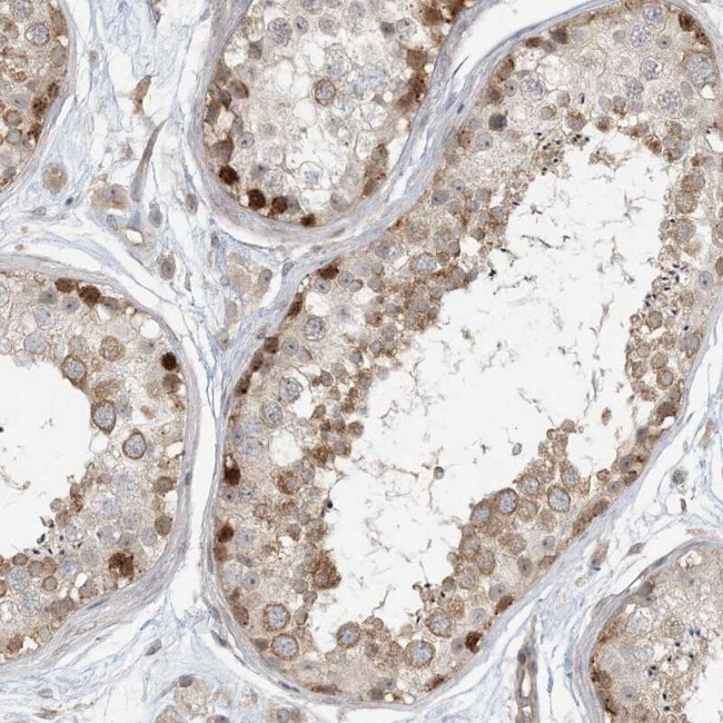 C13orf7 Antibody in Immunohistochemistry (IHC)