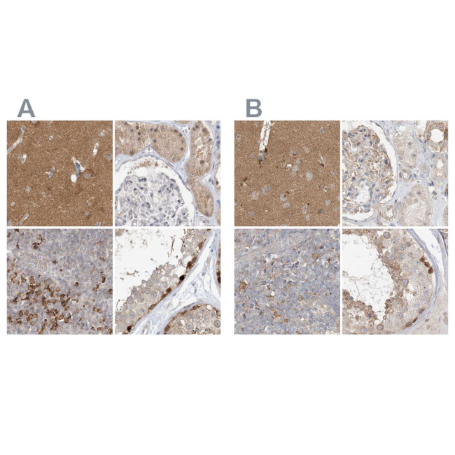 C13orf7 Antibody in Immunohistochemistry (IHC)