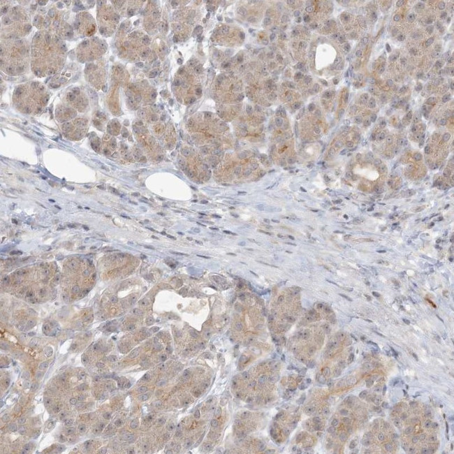 C13orf7 Antibody in Immunohistochemistry (IHC)