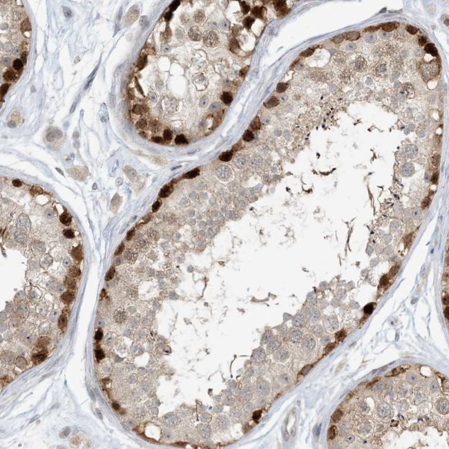 C13orf7 Antibody in Immunohistochemistry (IHC)