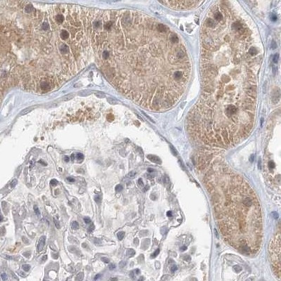 C13orf7 Antibody in Immunohistochemistry (IHC)