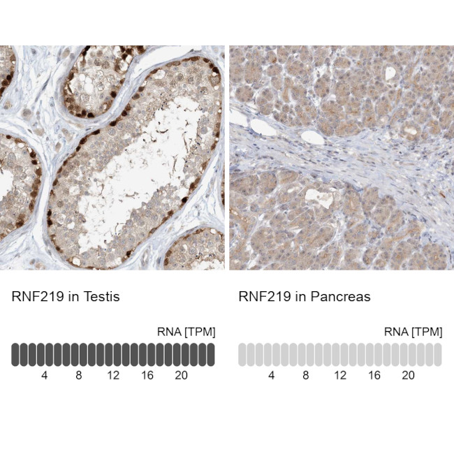 C13orf7 Antibody