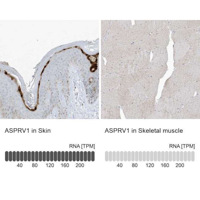 ASPRV1 Antibody in Immunohistochemistry (IHC)