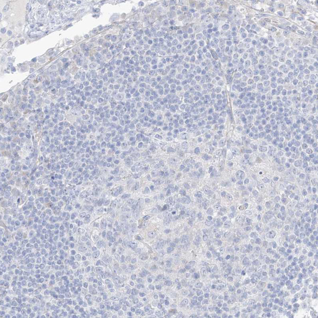 XIRP2 Antibody in Immunohistochemistry (IHC)