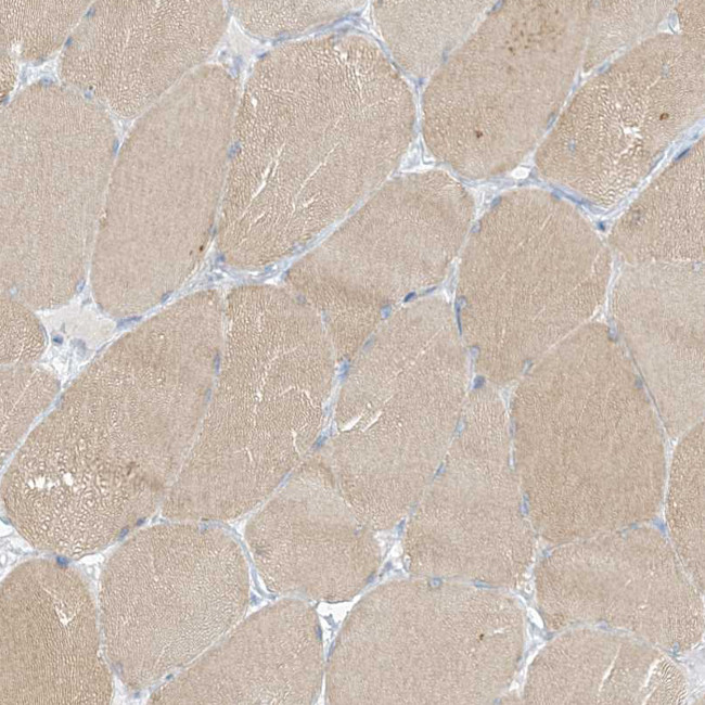 XIRP2 Antibody in Immunohistochemistry (IHC)