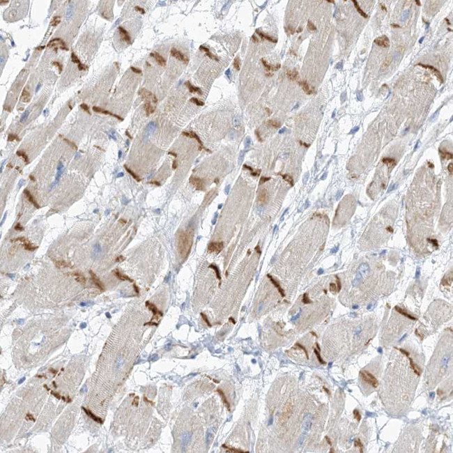 XIRP2 Antibody in Immunohistochemistry (IHC)