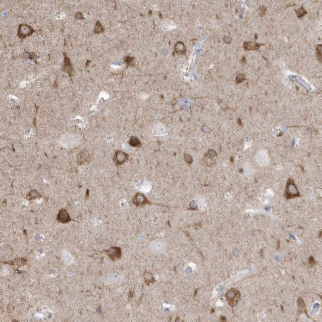 GTPBP8 Antibody in Immunohistochemistry (IHC)