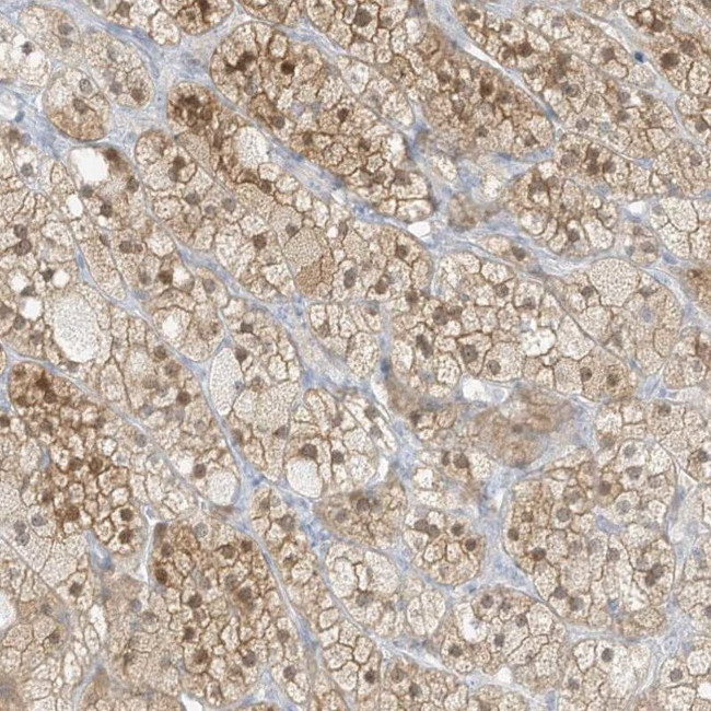 ZBTB41 Antibody in Immunohistochemistry (IHC)