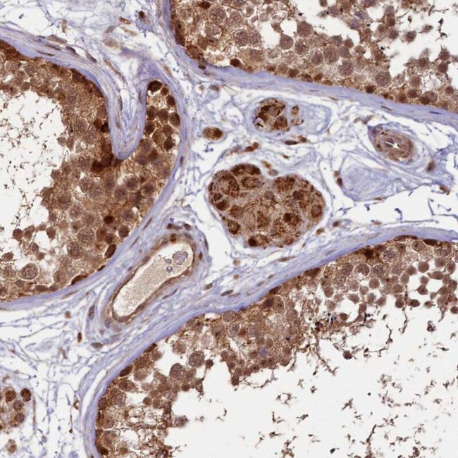 SHPRH Antibody in Immunohistochemistry (IHC)