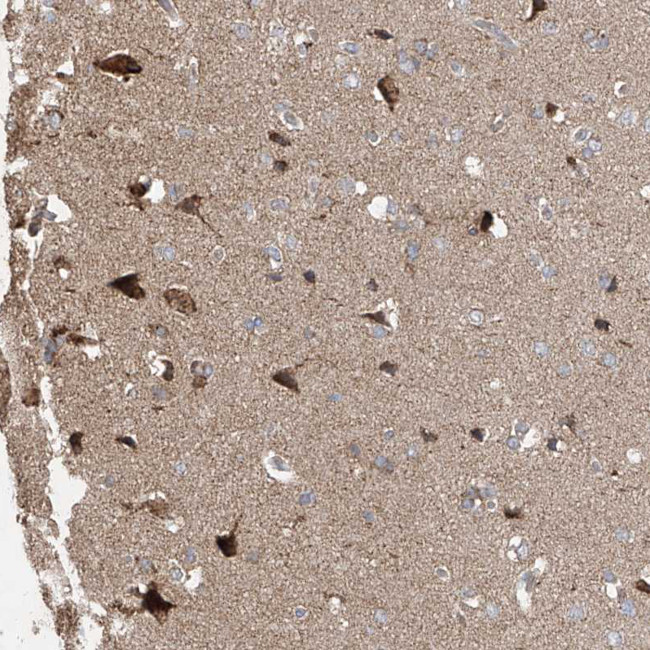 UQCC1 Antibody in Immunohistochemistry (IHC)