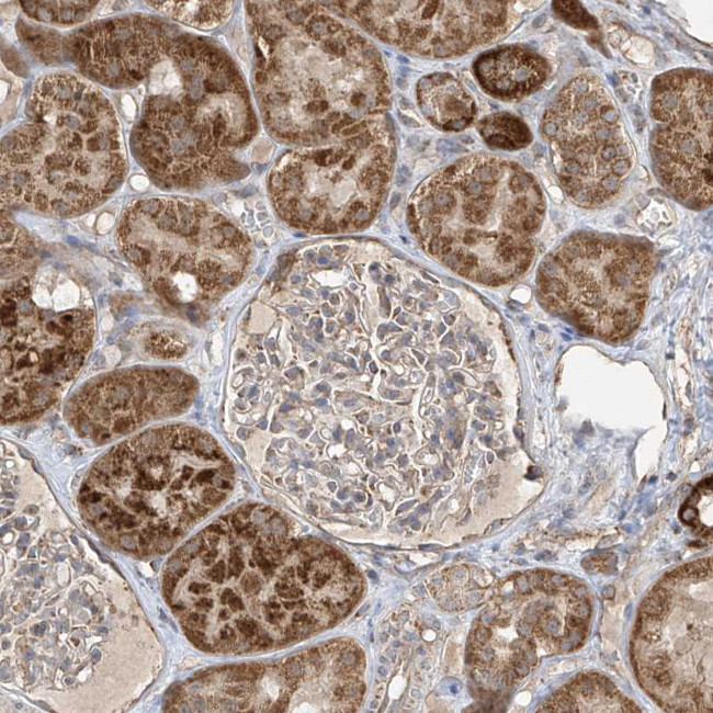 UQCC1 Antibody in Immunohistochemistry (IHC)