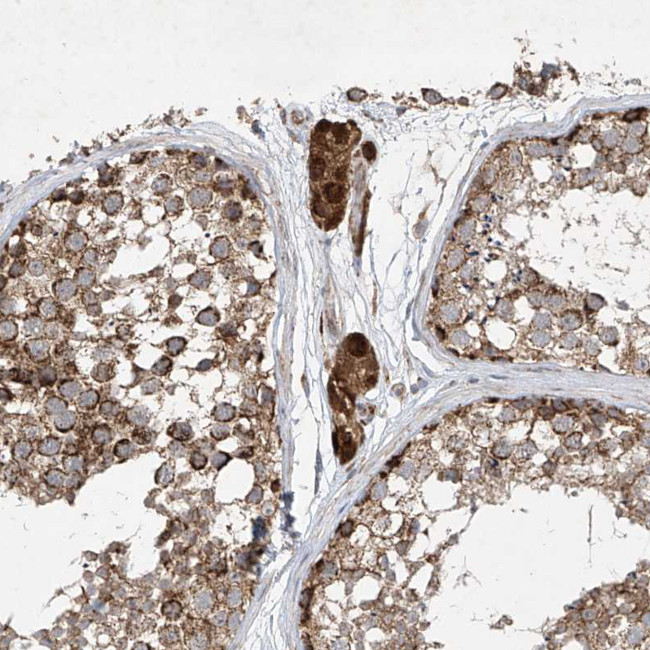 UQCC1 Antibody in Immunohistochemistry (IHC)