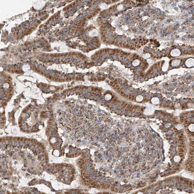 UQCC1 Antibody in Immunohistochemistry (IHC)