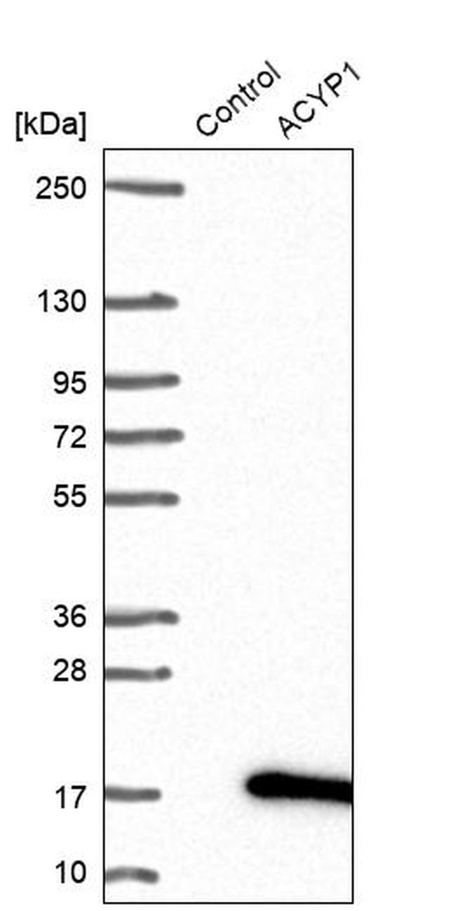 ACYP1 Antibody in Western Blot (WB)