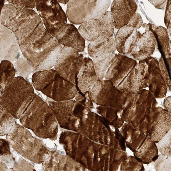 TAB3 Antibody in Immunohistochemistry (IHC)