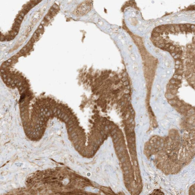 XRN1 Antibody in Immunohistochemistry (IHC)