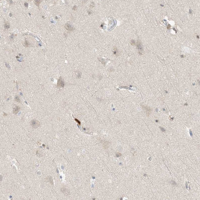 Grancalcin Antibody in Immunohistochemistry (IHC)