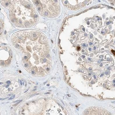 Grancalcin Antibody in Immunohistochemistry (IHC)