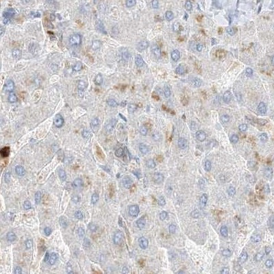 Grancalcin Antibody in Immunohistochemistry (IHC)