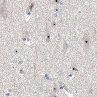 MPP10 Antibody in Immunohistochemistry (IHC)