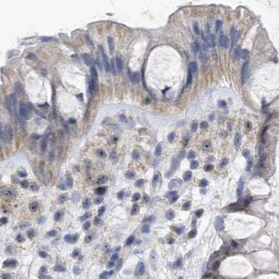 MPP10 Antibody in Immunohistochemistry (IHC)