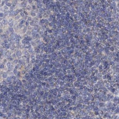 MPP10 Antibody in Immunohistochemistry (IHC)