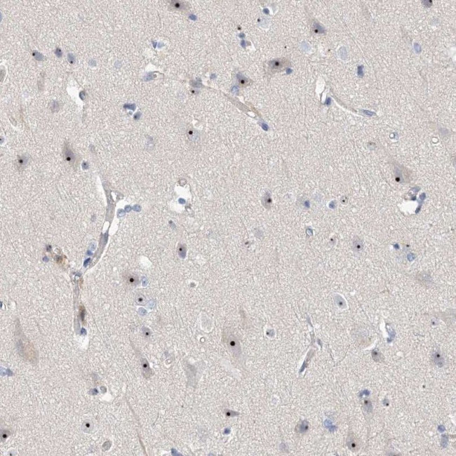 MPP10 Antibody in Immunohistochemistry (IHC)