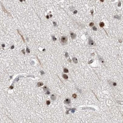 MPP10 Antibody in Immunohistochemistry (IHC)