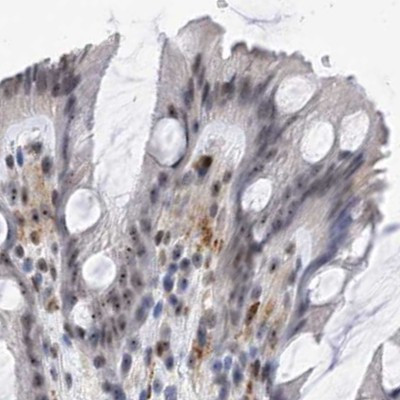 MPP10 Antibody in Immunohistochemistry (IHC)