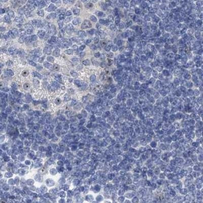 MPP10 Antibody in Immunohistochemistry (IHC)