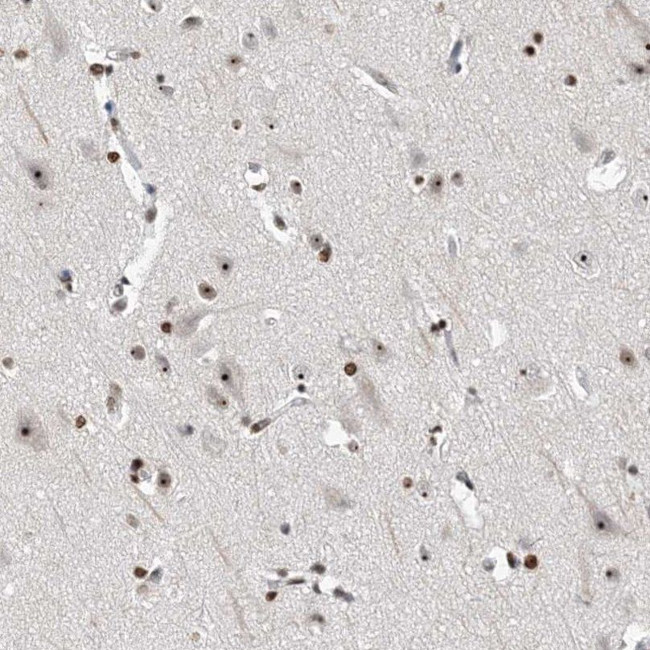 MPP10 Antibody in Immunohistochemistry (IHC)