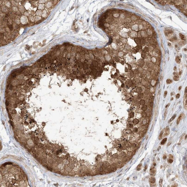 TBCC Antibody in Immunohistochemistry (IHC)