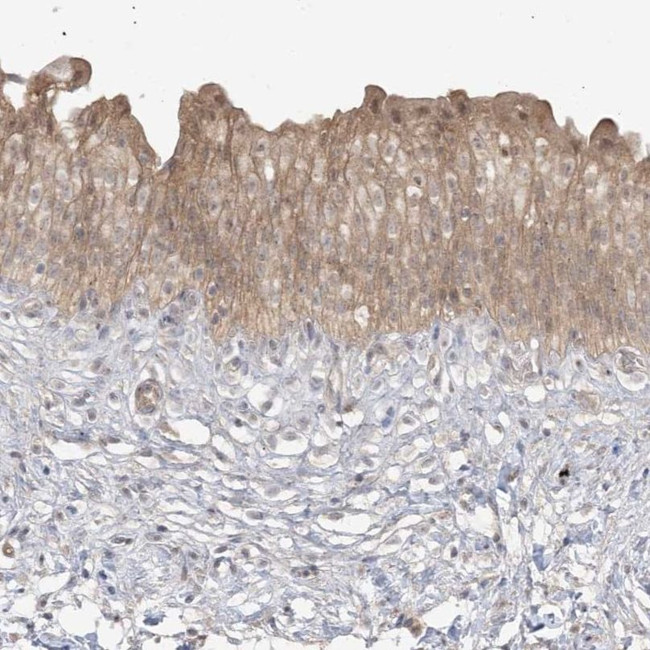 TBCC Antibody in Immunohistochemistry (IHC)