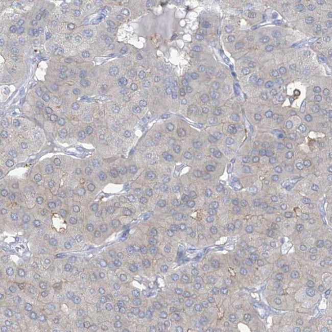 TRMT2B Antibody in Immunohistochemistry (IHC)