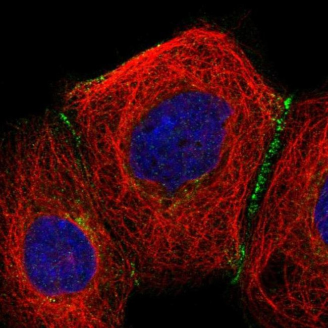 SLC9A2 Antibody in Immunocytochemistry (ICC/IF)