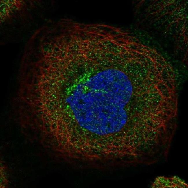 TBC1D5 Antibody in Immunocytochemistry (ICC/IF)