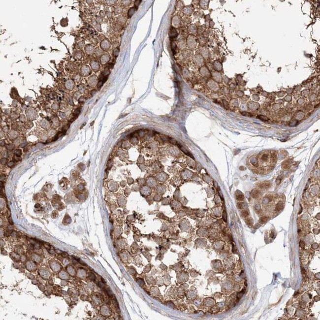 TBC1D5 Antibody in Immunohistochemistry (IHC)