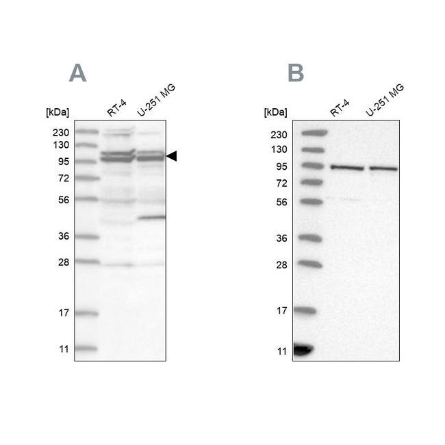 TBC1D5 Antibody in Western Blot (WB)