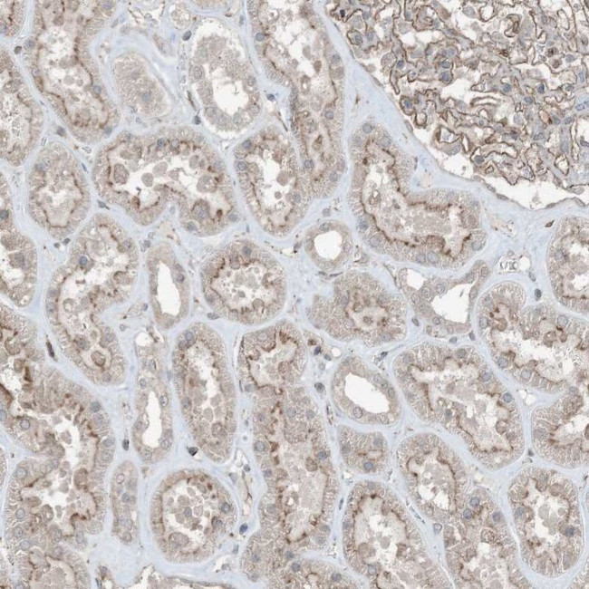 ZFAND2B Antibody in Immunohistochemistry (IHC)