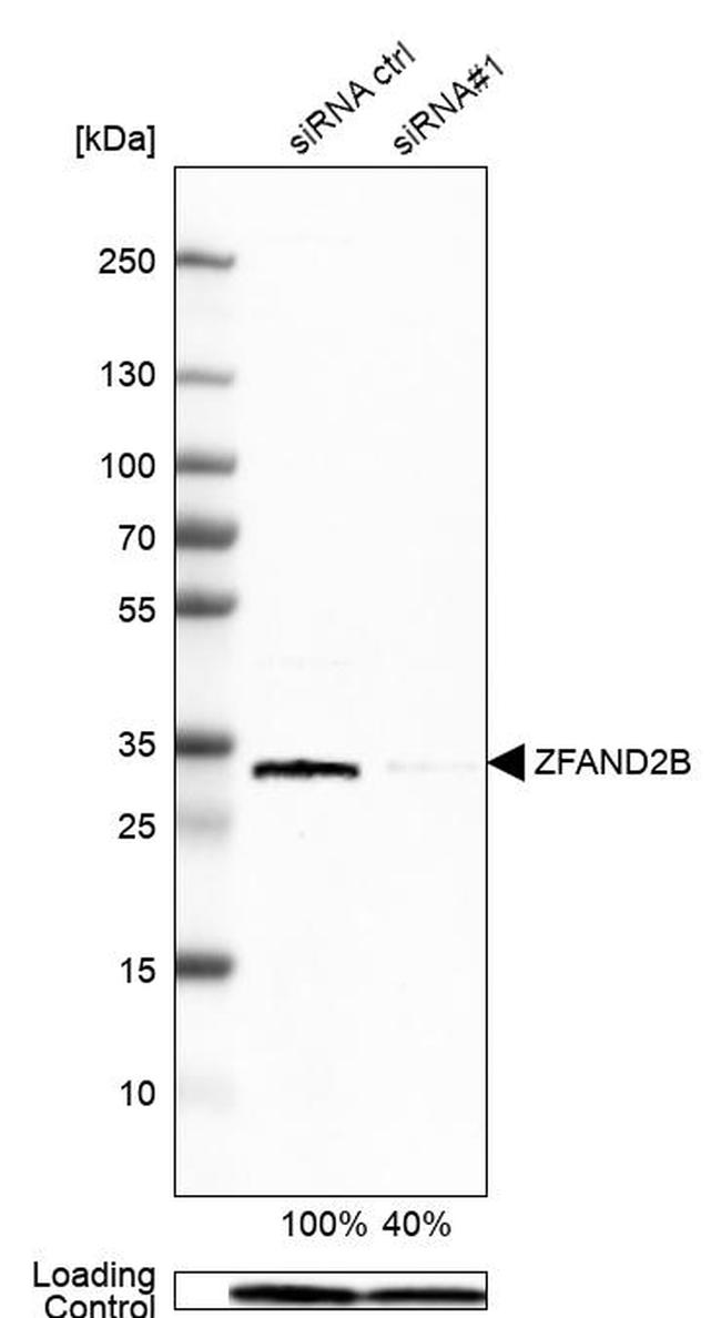 ZFAND2B Antibody in Western Blot (WB)