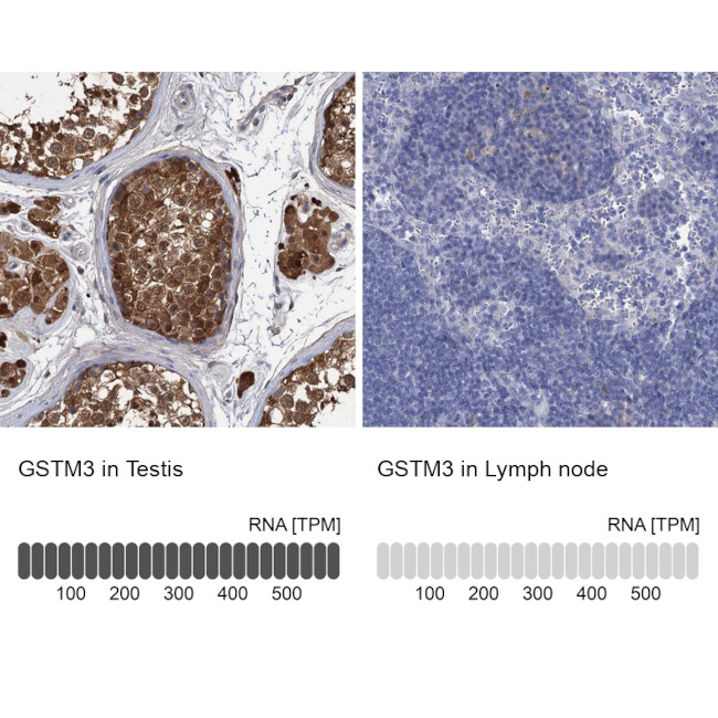 GSTM3 Antibody in Immunohistochemistry (IHC)