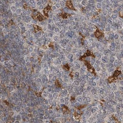 NAGK Antibody in Immunohistochemistry (IHC)