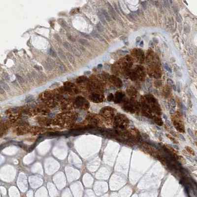 NAGK Antibody in Immunohistochemistry (IHC)