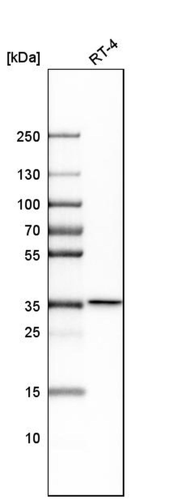 NAGK Antibody in Western Blot (WB)