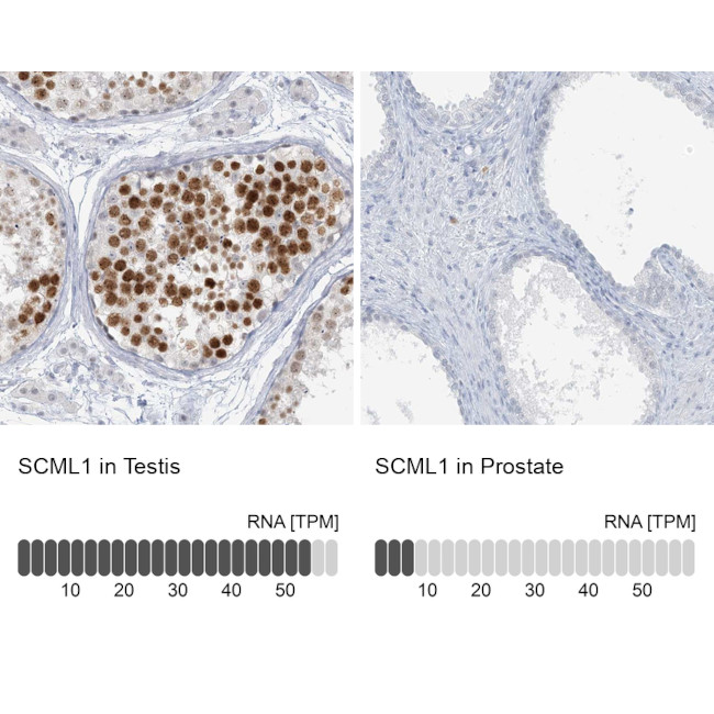 SCML1 Antibody in Immunohistochemistry (IHC)