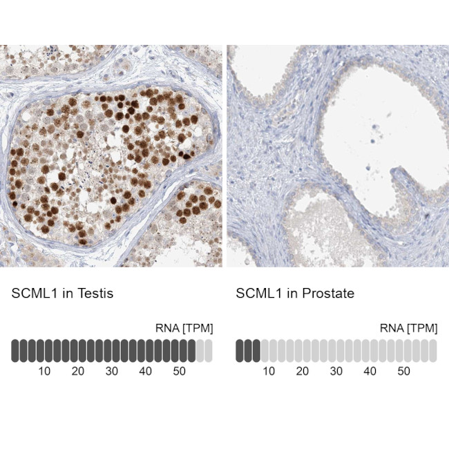 SCML1 Antibody in Immunohistochemistry (IHC)